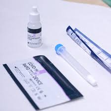 test de antígenos madrid detección