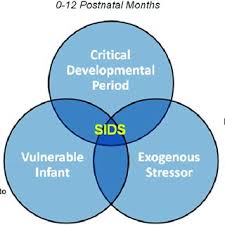Sids Risk Factors By Age Group A Download Table