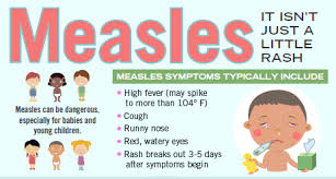 measles louisvilleky gov
