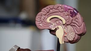 alzheimer s brain vs normal brain