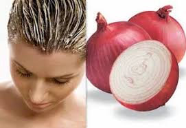 onion juice hair solutions at best