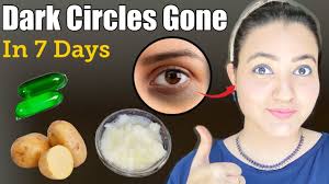 remove dark circles spots puffy eyes