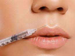 reverse lip fillers with hyaluronidase