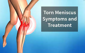 torn meniscus symptoms and treatment