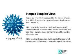 herpes treatment dr rana s