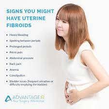 is uterine fibroid removal possible