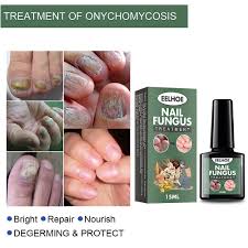 nail repair gel toenail fungus