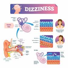 But, to help relieve bppv sooner, your doctor, audiologist or this procedure usually works after one or two treatments. Giddiness Dizziness Causes Symptoms Treatment Nh