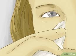 black circles under your eyes wikihow