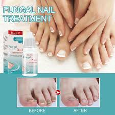 oil toenail nail repair solution