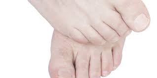 Merendam kaki dengan air garam dapat menyembuhkan luka dengan cepat, karena memiliki sifat anti bakteri dan kuman. 6 Manfaat Merendam Kaki Dengan Air Garam Hilangkan Bau Hingga Bikin Tidur Nyenyak