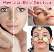 dark spots on your face natural