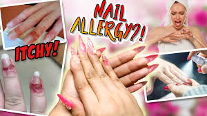 nail allergy remedy that will