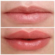 permanent lip blushing treatment in