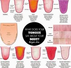 Traditional Chinese Medicine What Does You Tongue Say About