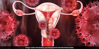 3 4 lakh cervical cancer cases reported