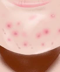 what causes red spots on skin guide to