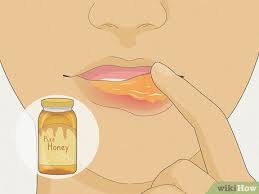 how to heal a swollen lip quickly 11