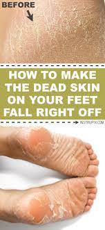 foot soak for dead skin that actually works