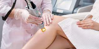 laser hair removal can pregnant women