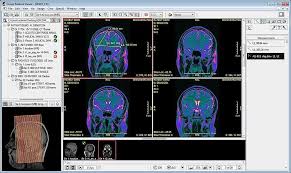 Dicom (digital imaging and communications in medicine) is a standard format that enables medical professionals to view, store, and share medical images irrespective of their geographic location. 5 Dicom Viewers For Any Practice