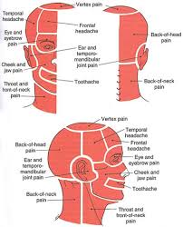 Head And Neck The Trigger Point Referred Pain Guide