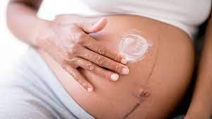 skin changes during pregnancy is