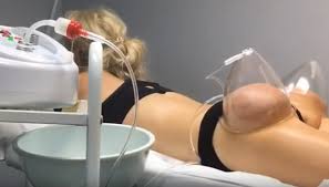 Endoscopic vacuum therapy (evt) is increasingly being used as a promising alternative. Butt Vacuum Therapy How It Works Bella Vacuum