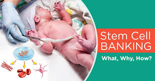 stem cell banking