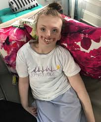 a 10 year old with rett syndrome spent