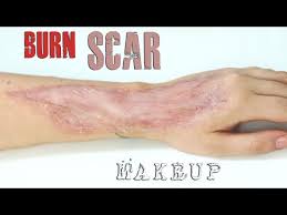 burn scar makeup tutorial freakmo