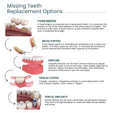 options for missing teeth replacement