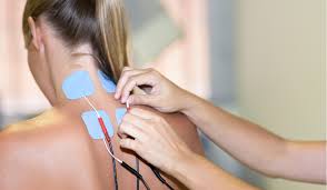 types of electrical stimulation
