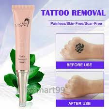 permanent tattoo removal cream removal