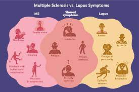 differences between lupus