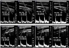 standardized ultrasound evaluation of