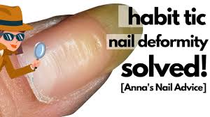 habit tic nail deformity solved