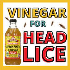 vinegar kill lice or loosen nits