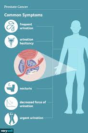 prostate cancer signs symptoms and