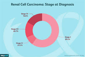Renal Cell Carcinoma Symptoms Causes Diagnosis And Treatment