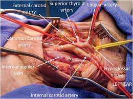 What's the difference between arteries and veins? Chapter 8 Carotid Artery And Internal Jugular Vein Injuries Anesthesia Key