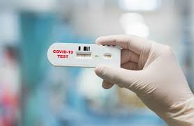 The škoda rapid is a name used for models produced by the czech manufacturer škoda auto. What To Know About Rapid Covid Testing Covid Rapid Antigen Test