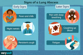 lung abscess symptoms causes