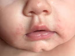 baby skin photos common issues and