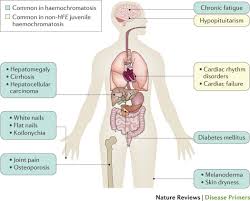 Haemochromatosis Nature Reviews Disease Primers