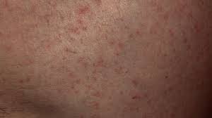 red dots on skin pictures causes
