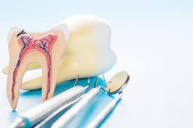 Root Canals - Lakeside Dental - Maine