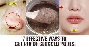 clogged pores