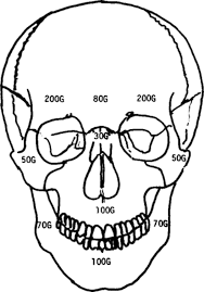 You can feel your skull by pushing on your head, especially in the back a few inches above your neck. The Impact Absorbing Effects Of Facial Fractures In Closed Head Injuries In Journal Of Neurosurgery Volume 66 Issue 4 1987