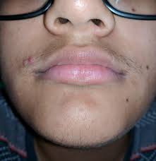 If you are an ftm transgender guy who has started hormone replacement therapy, you might be wondering if you will be able to grow facial hair. Will Beard Dye Help My Facial Hair Stand Out More Ftm